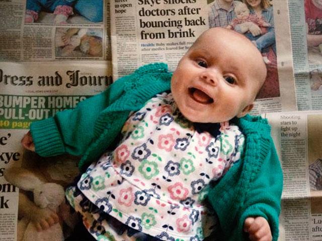  baby skye edwards