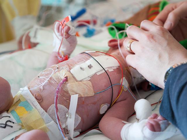 infant in intensive care