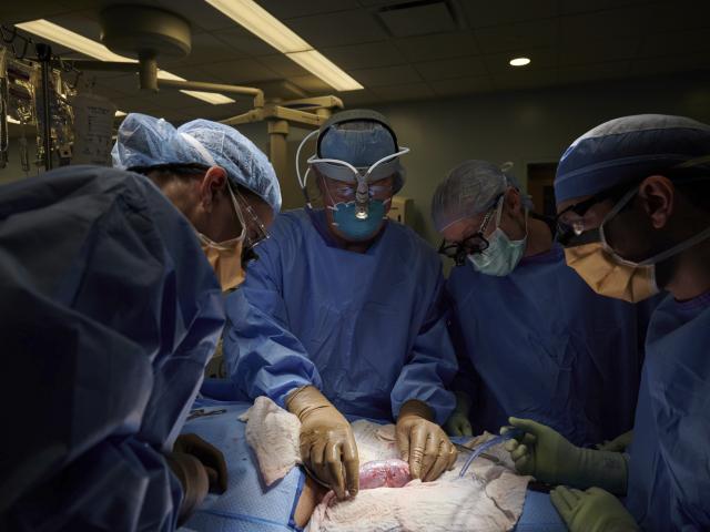 In this September 2021 photo provided by NYU Langone Health, a surgical team at the hospital in New York examines a pig kidney attached to the body of a deceased recipient for any signs of rejection. (Joe Carrotta/NYU Langone Health via AP)