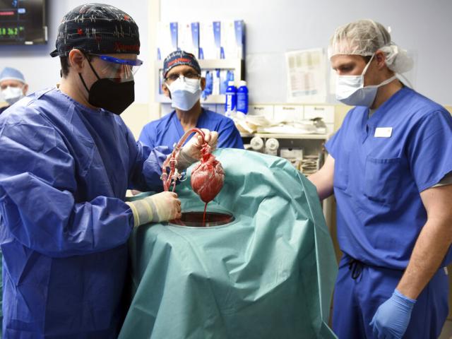 In this photo provided by the University of Maryland School of Medicine, members of the surgical team show the pig heart for transplant into patient David Bennett in Baltimore on Friday, Jan. 7, 2022. (AP Photo)