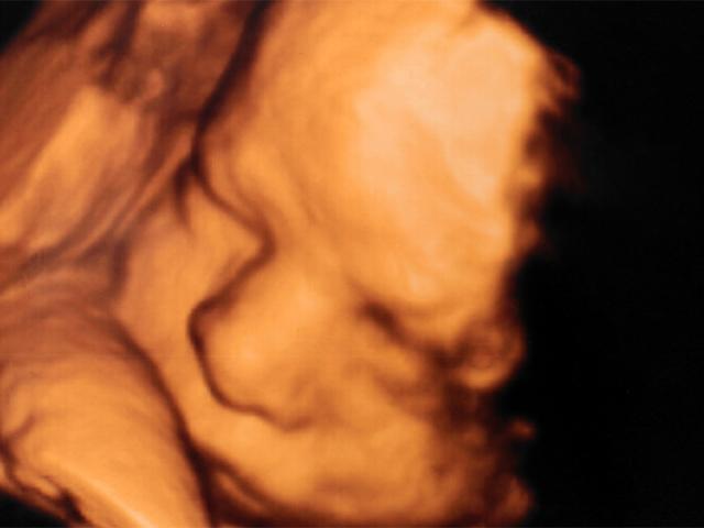 Ultrasound showing an unborn baby in the womb