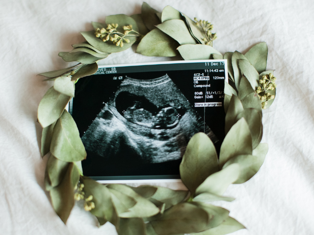 sonogram image of preborn baby