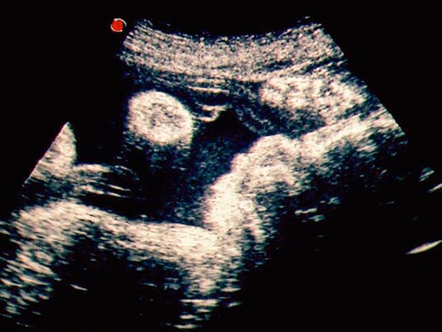 ultrasound image