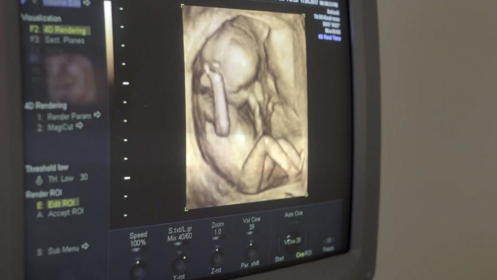3D ultrasound reveals fully formed unborn baby in the womb (Adobe stock image)