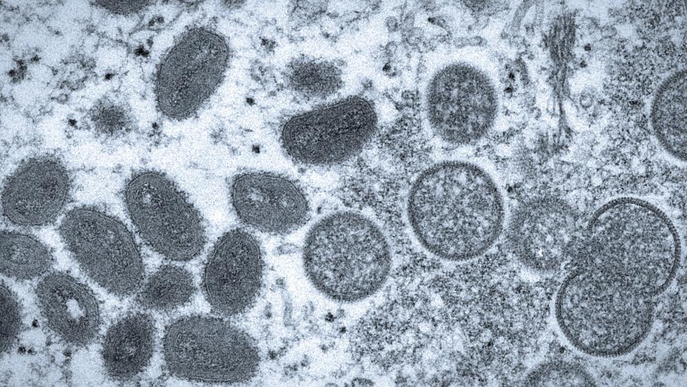 A 2003 electron microscope image made available by the Centers for Disease Control and Prevention shows mature, oval-shaped monkeypox virions, left, and spherical immature virions, right (Cynthia S. Goldsmith, Russell Regner/CDC via AP, file)