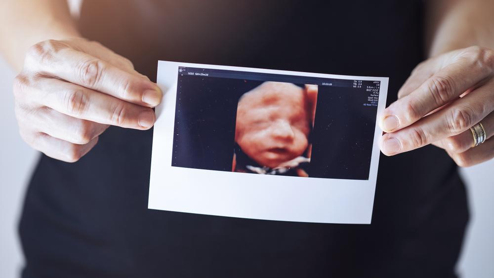 3D ultrasound of an unborn baby (Adobe stock photo)